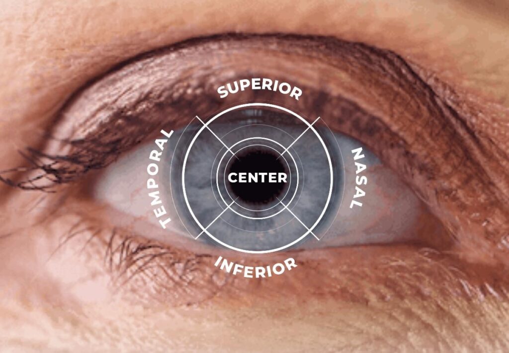 Anatomical diagram of a human eye with superior, inferior, temporal, nasal, and center labels.