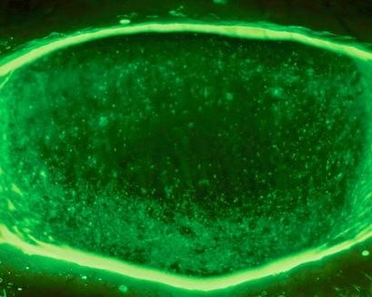 Glowing bright green border outlines an oval filled with countless luminous specks.