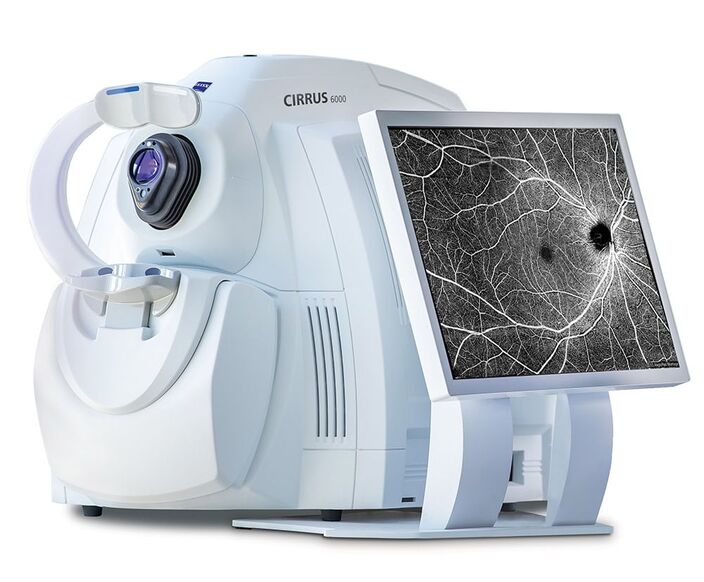 White ZEISS eye scanner displaying a detailed black and white retinal blood vessel image.