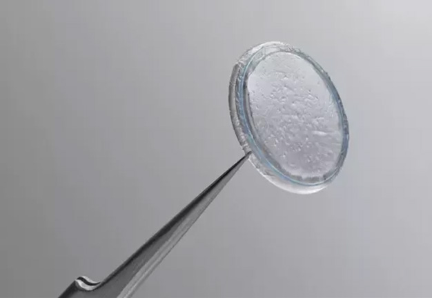 Home 12 Tweezers holding a clear, round contact lens with many small trapped bubbles.
